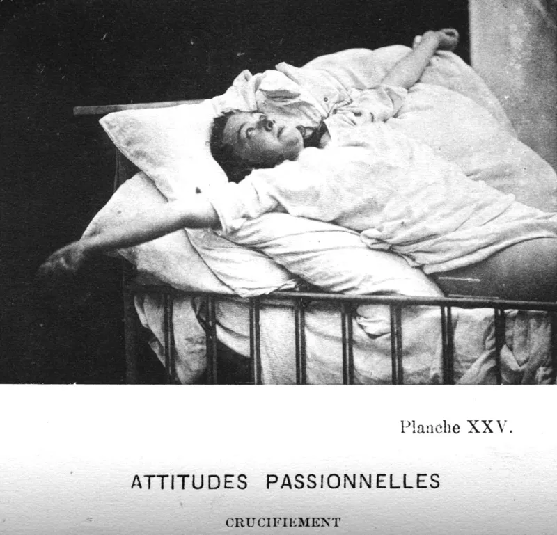 Photograph of Augustine from the Iconographie photographique de la Salpêtrière showing her in an 'attitudes passionnelles' pose