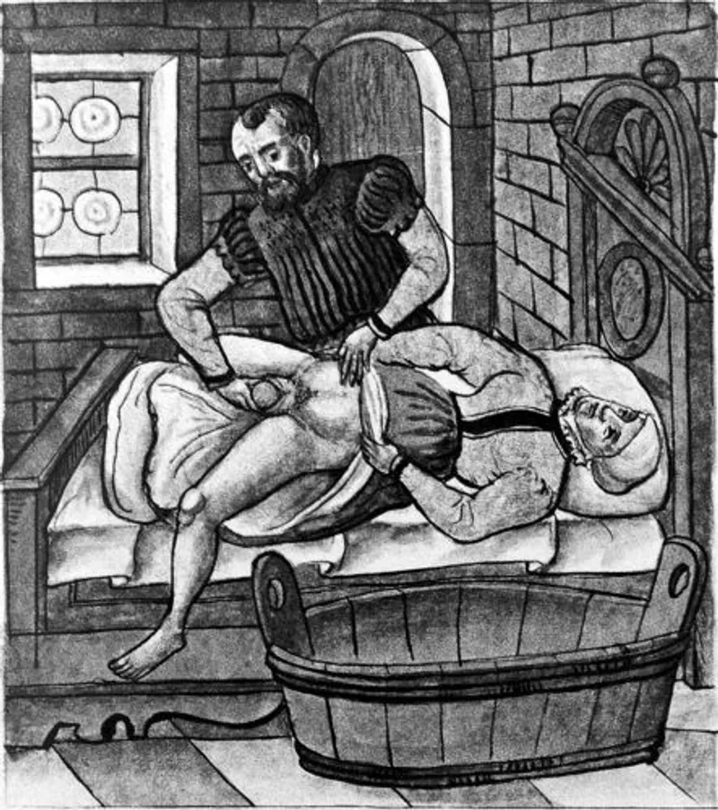 Treating a prolapsed womb. (Wellcome Images)