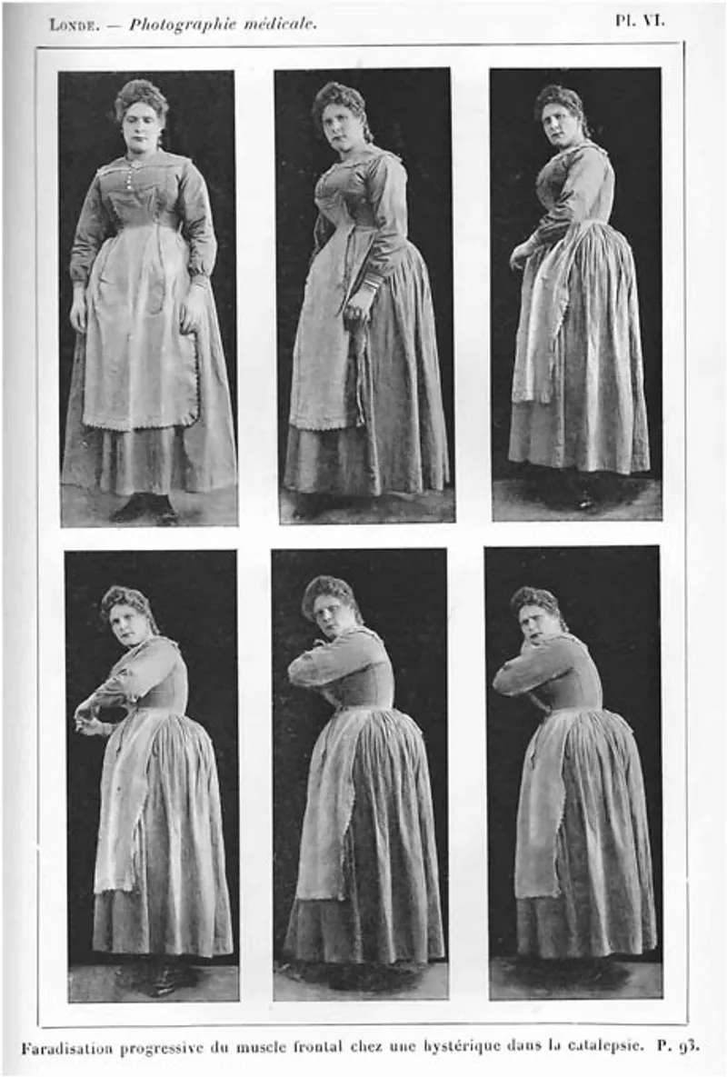 Blanche photographed under hypnosis (1893). (Wikimedia Commons)