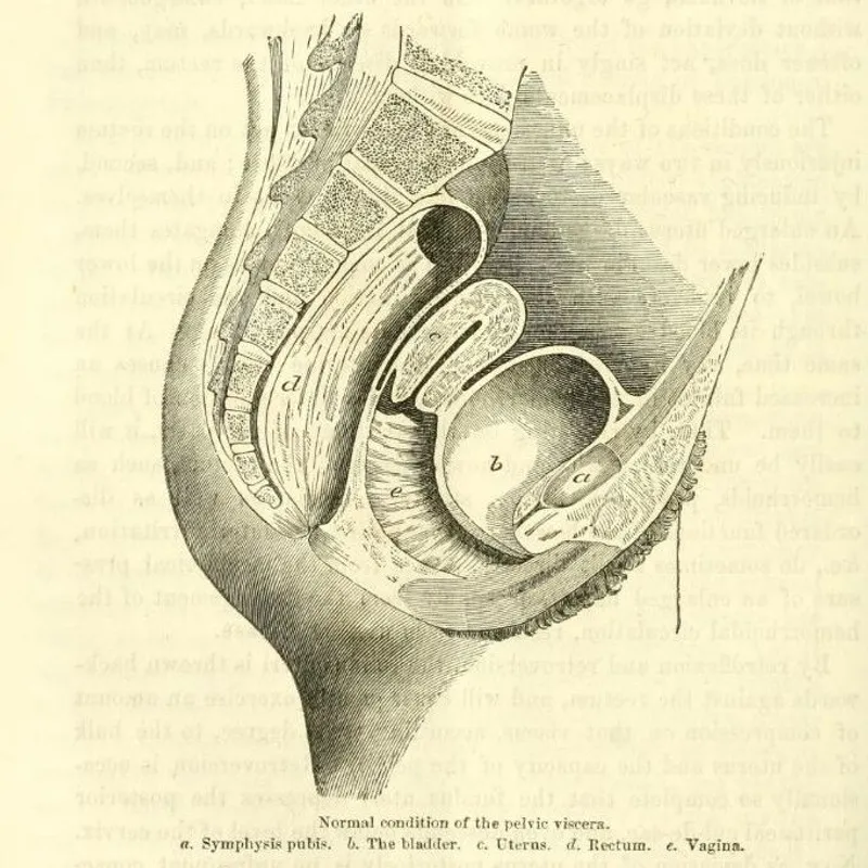 Pelvic anatomy in Isaac Baker Brown's On some diseases of women admitting of surgical treatment. Credit: Wellcome Images.
