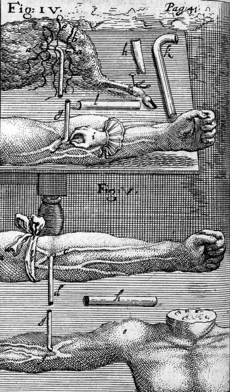 A detailed illustration of early blood transfusion techniques used in the 17th century, showcasing the setup for transferring blood between animals and humans.