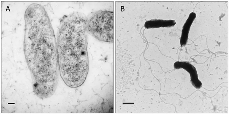 Electron micrograph showing Bartonella bacilliformis, the bacterium responsible for Carrion’s disease, transmitted by sandflies. (Image source: Wikimedia Commons)