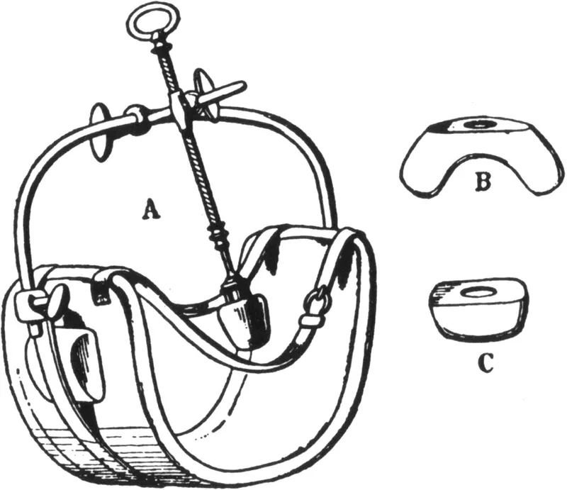 Technical diagram of an ovary compressor device with leather belt and metal screw mechanism, labelled A, B, and C